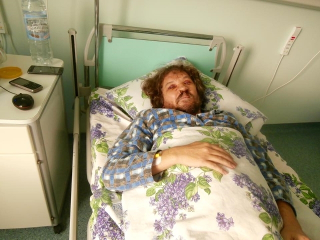 Андрей Рудомаха после избиения в больнице